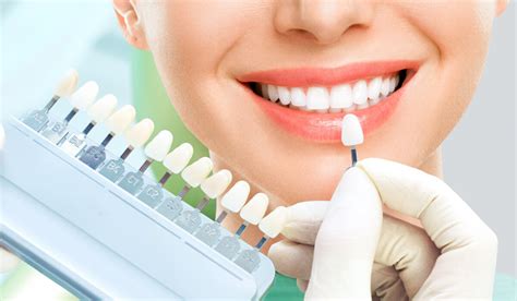 Dental veneers hallam  Technicians use good quality materials like porcelain, or tooth-colored composite to make up these coverings